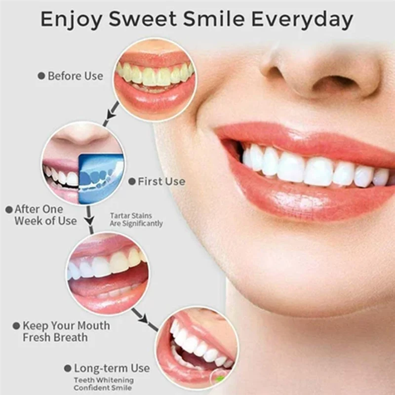 

【Горячая распродажа!】Электрический ирригатор для полости рта Портативный ирригатор для полости рта Электрический ирригатор для полости рта Портативный электрический телескопический ирригатор для полости рта
