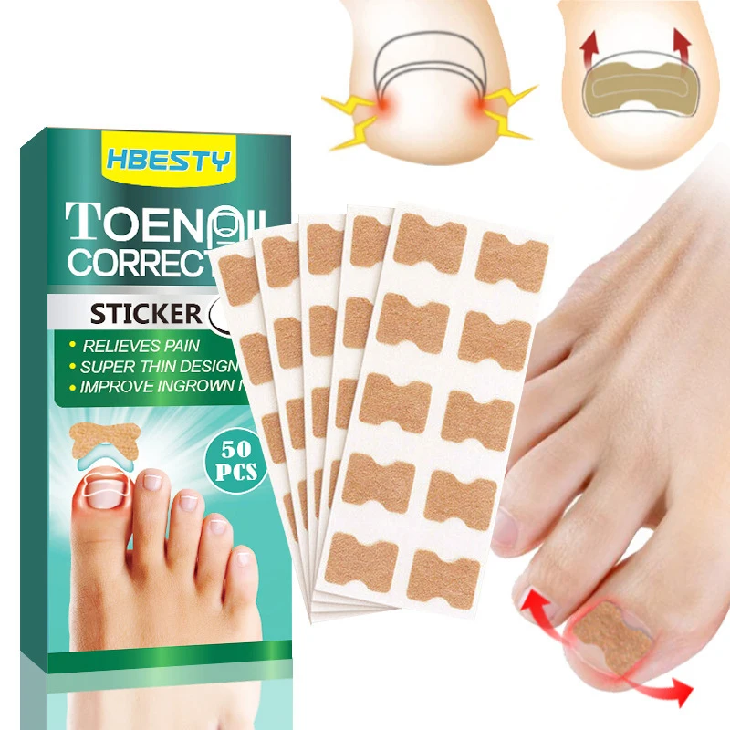 50Pcs Ingrown Nail Correction Stickers Paronychia Treatment Recover Corrector Pedicure Tool Nail Correction Care Stickers