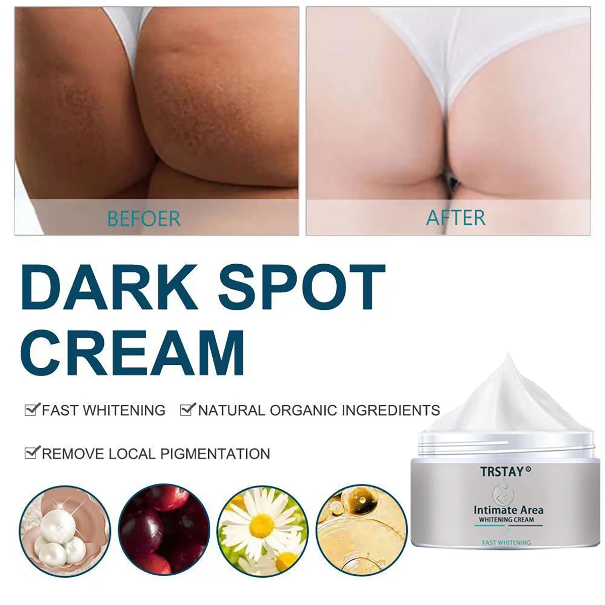TRSTAY Crema Sbiancante per Aree Prize - Rimozione Efficace della Pigmentazione Locale Cura della Pelle per Donne Incinte
