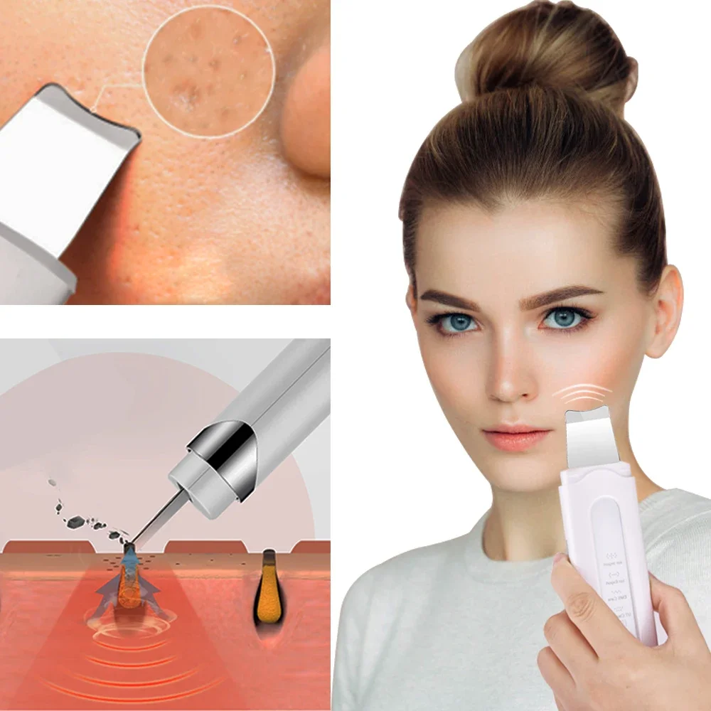 NEW Portable Ultrasonic Nano Ion Scrubber Face Lift Peel Extractor Deep Cleaning Shovel Device Face Steamer Sprayer