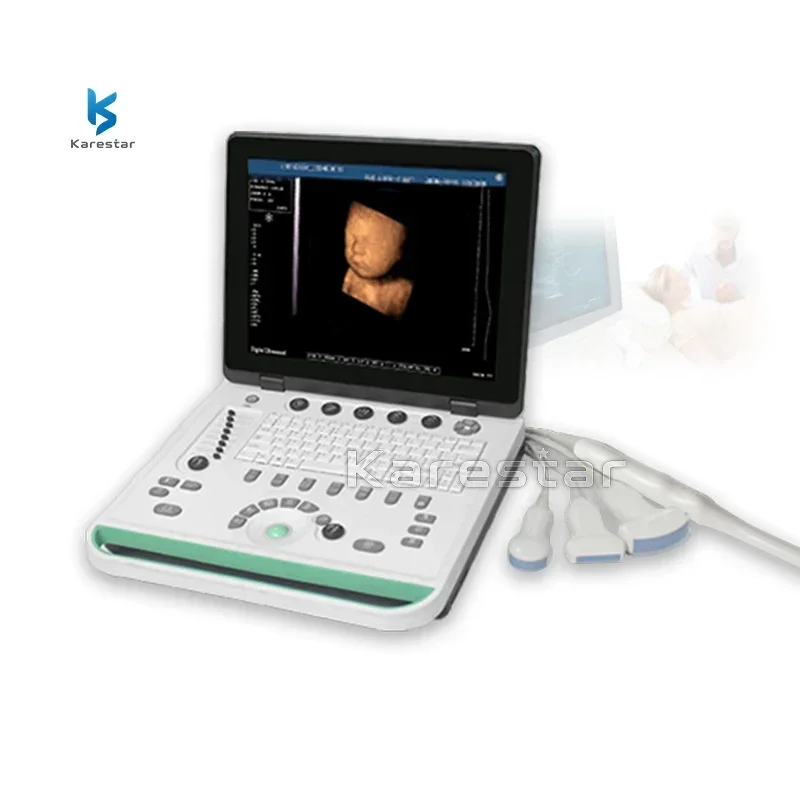 Cardiac Portable Color Doppler Ultrasound Machine Price Medical Sonar 2d 3d 4d Echocardiography Ecografo  Echo Machine