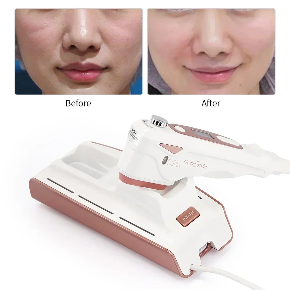 Mini Home Focus Beauty Machine Treatment Skin Firming Face Lift Delicate Beauty Skin Anti-wrinkle Aging Whitening Care Device