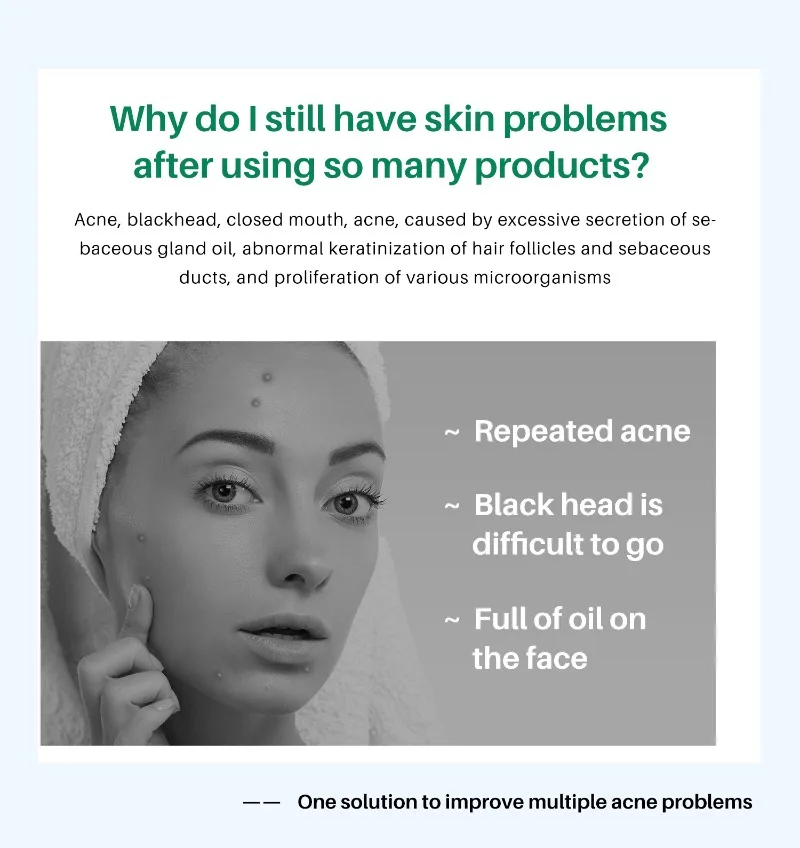 Crème anti-taches de rousseur pour hommes et femmes, extrait de plante, élimine les marques d'acné, blanchissante, hydratante, soins de la peau