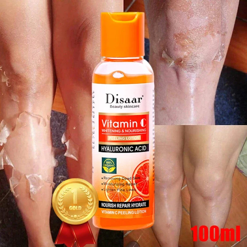 Yellow Peeling Lotion Oil 100% Organic Bleaching Dark Skin Exfoliating Whitening Nuurishing Hyaluronic Acid Moisturiz Body Scrub