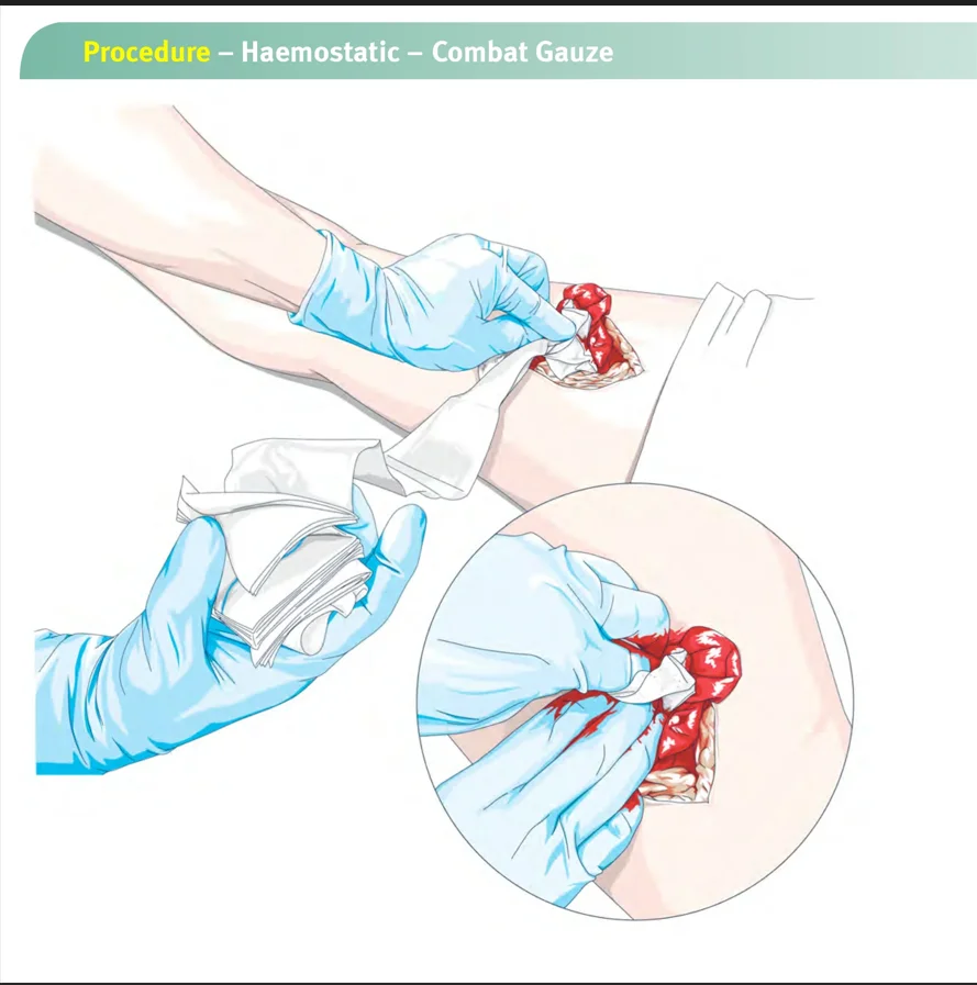 Outdoor Emergency Kaolin Hemostatic Gauze Outdoor Emergency Mountaineering Multi functional Aseptic Compression Hemostatic Gauze