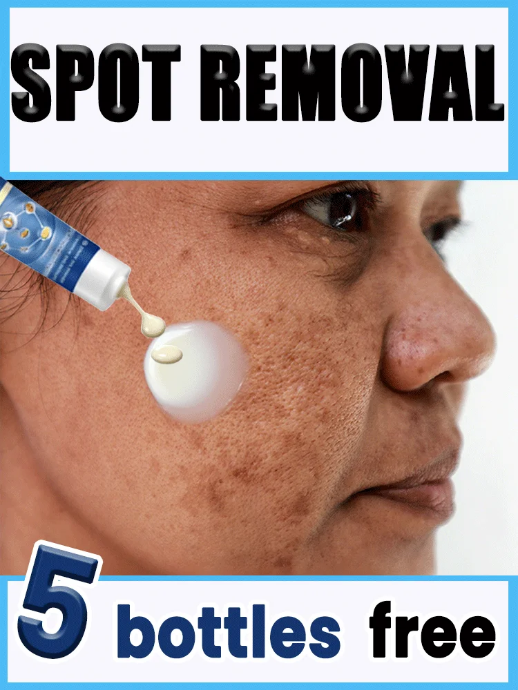 

Lightening Spot Serum - Natural Ingredients for Even Skin Tone