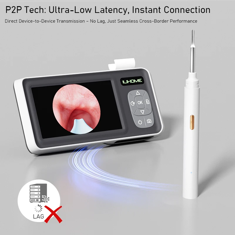 4.3'' IPS Screen Otoscope Point to Point Ear Scope Camera 4.2mm Digital Ear Picker Ear Cleaning Ear Wax Removal Endoscope