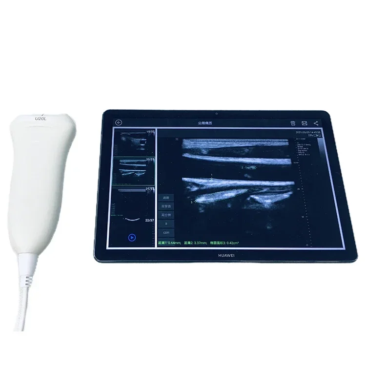 Upgrade Handheld Pocket USB Type C Linear Ultrasound Scanner Probe With Ultrasound Software