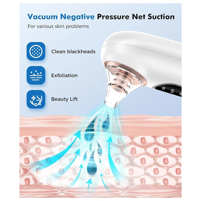 【VENDA QUENTE】 Limpador de poros faciais removedor de cravo para peles sensíveis com kit de aço inoxidável de 4 cabeças removíveis