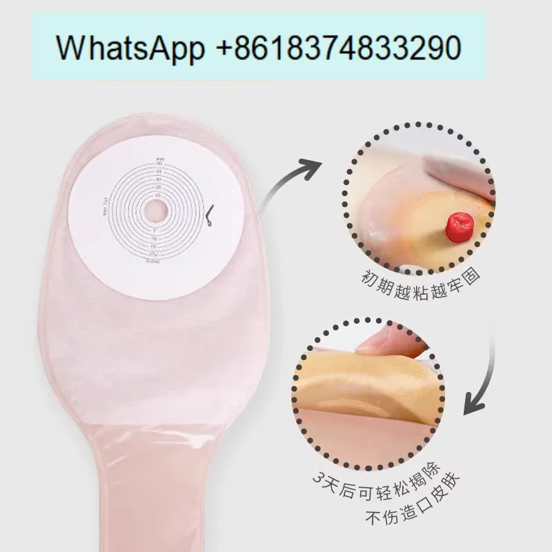 Ostomy bag one-piece 1902 medical rectal diversion fistula stool bag official flagship store for care products