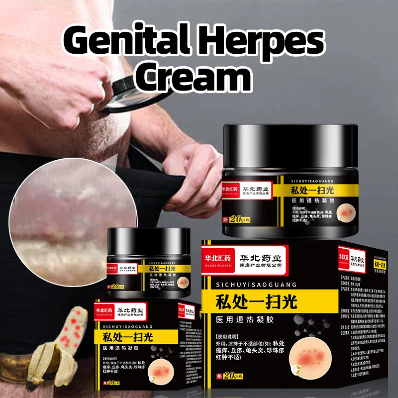 Pomada para eliminación de Herpes Genital para hombre, crema para tratamiento de la Balanitis, Candida, medicina para curar, quitapápulas nacaradas, 20g, 2 cajas