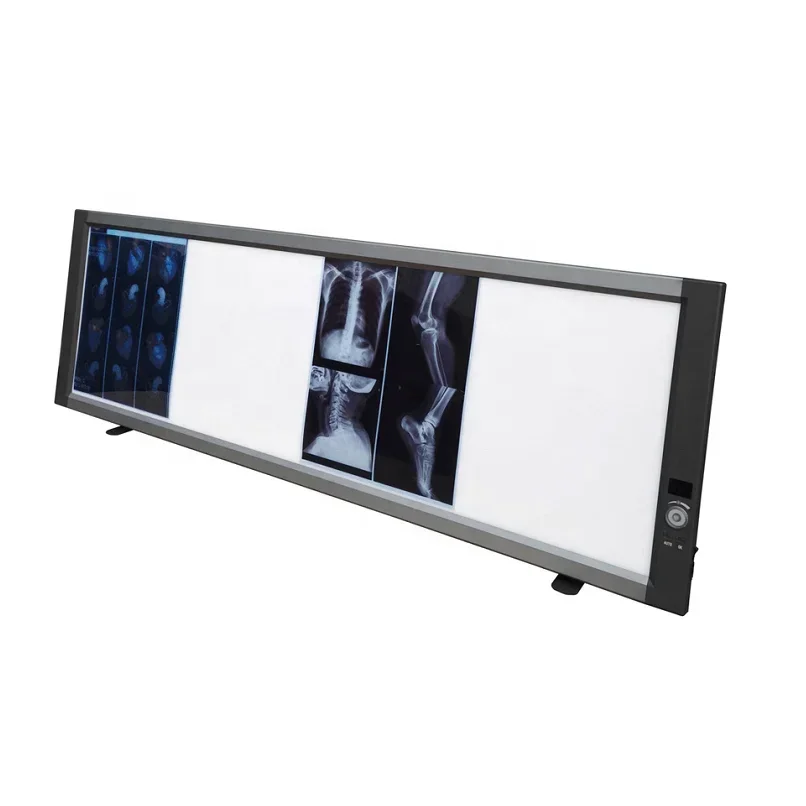 2026/X-ray LED Triple Film Viewer Radiographic Film Viewer Medical led Negatoscope