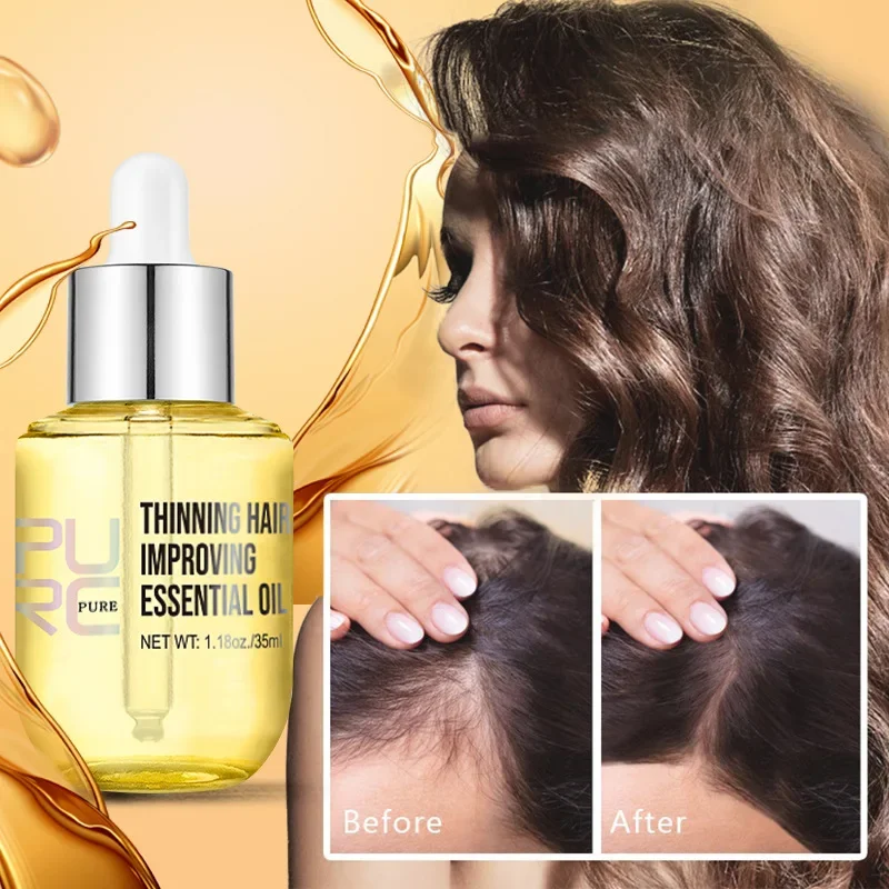 

1pc Ginger Hair Growth Oil Fast Hair Loss Treatment Smoothing Repair Damaged Hair Growth Products for Men Women HairCare