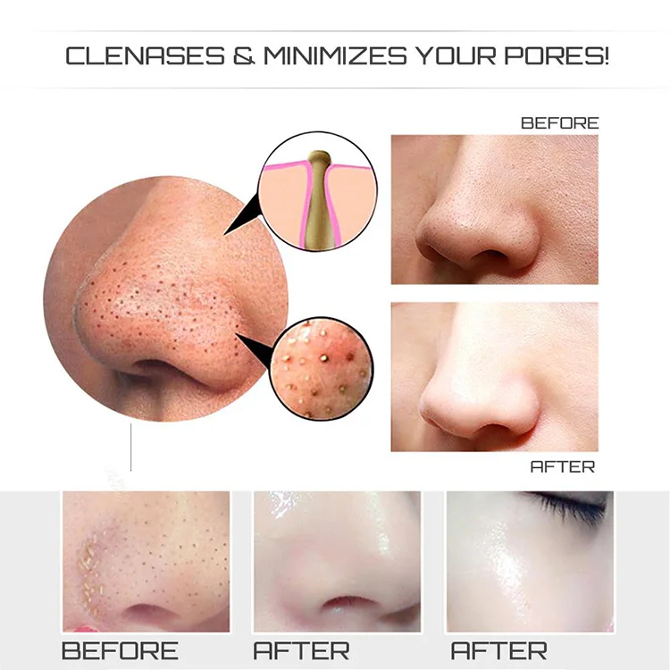 مزيل الرؤوس السوداء متعدد الأوضاع للمكتبة الذكية مع جهاز تقليل المسام المضاد لحب الشباب #3