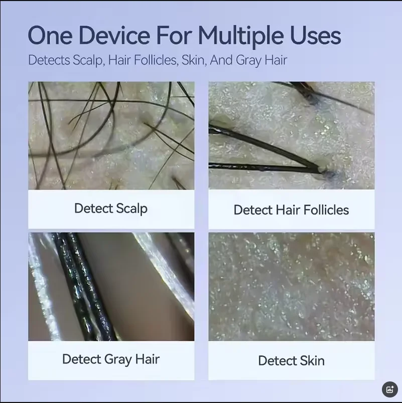 Analisador de diagnóstico de pele sem fio WiFi USB recarregável analisador de couro cabeludo detector máquina analisadora de cabelo