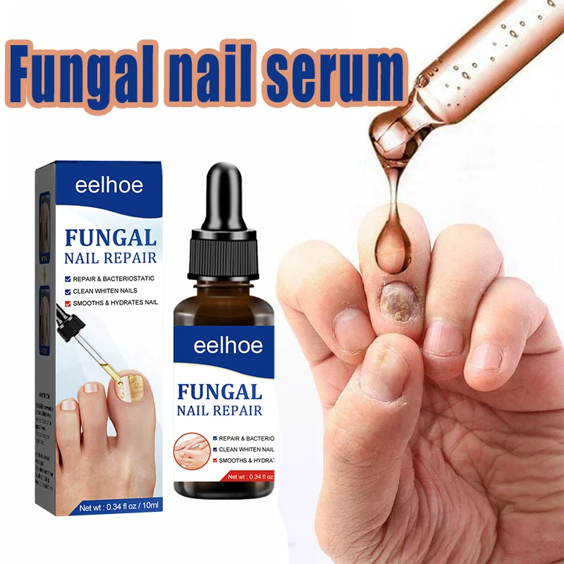 Sérum de soin de l'onychomycose, solution hydratante réparatrice pour la santé des ongles des pieds