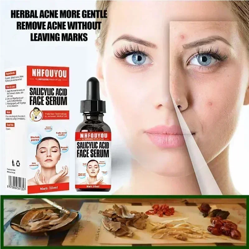 Venda quente solução de ácido salicílico essência 10ml encolher poros e acne remoção de manchas encolher poros óleo-controle iluminar a pele do rosto