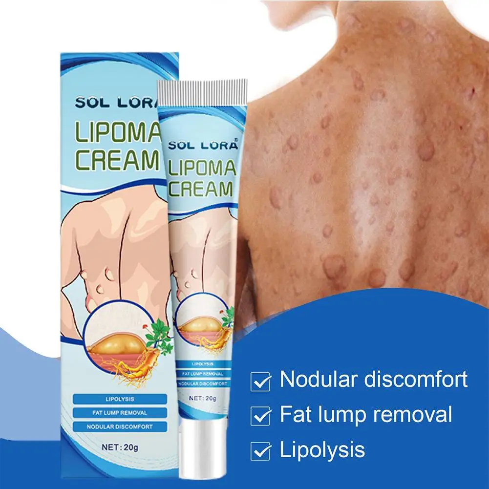 20g Lipoma Remove Cream Body Care Cream Relieve Lipoma Fat Lumps and Subcutaneous Lumps Fibroid Removal Reduce Inflammatio