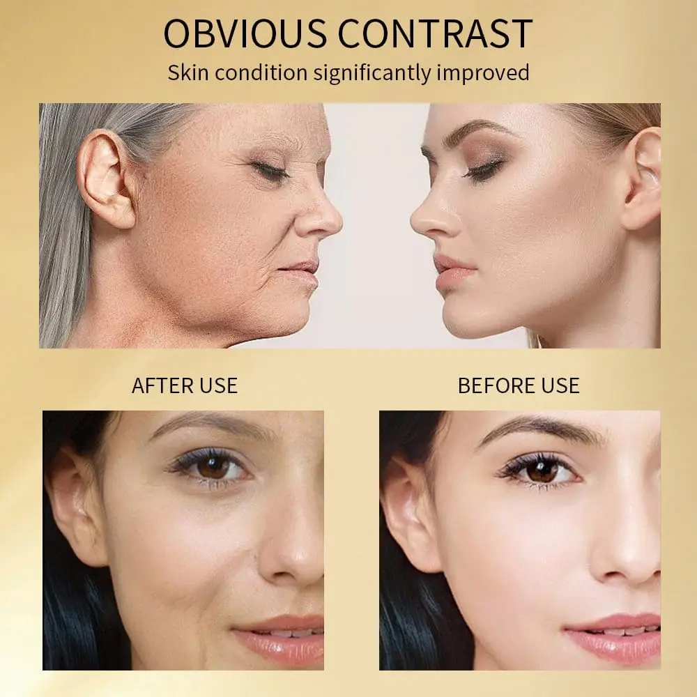 Serum z nikotynamidem i złotem 24-karatowym - Przeciwstarzeniowe, na przebarwienia i trądzik do twarzy - Nawilżająco-rozjaśniająca formuła (30 ml)