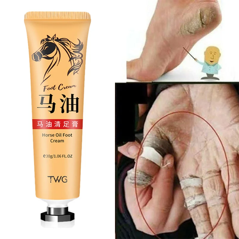 Crack ครีมส้นเท้าแตกซ่อม Horse Oil ครีมกำจัดขน Dead Skin แคลลัส Anti-Drying มือ skin Care 30G