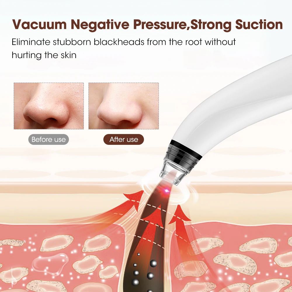 Electric Blackhead Remover Deep Clean Pore Acne Pimple Removal Vacuum Suction Tool with Camera Visual Facial Beauty Machine