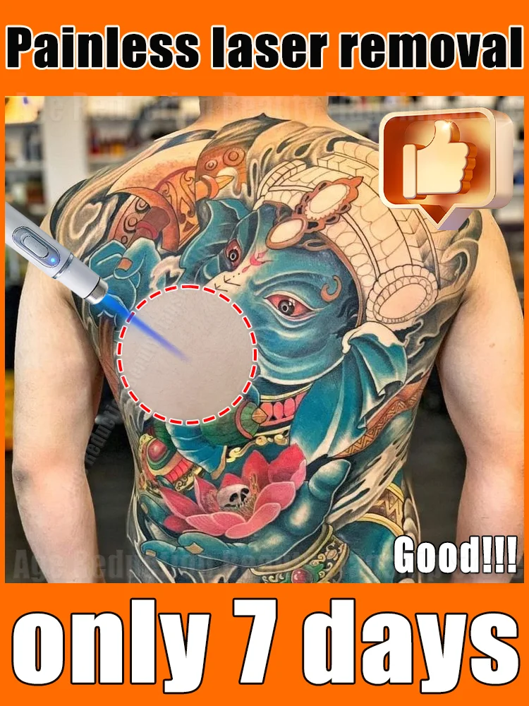 

Hot-selling products in 2025:Pᴀɪɴʟᴇss ᴛᴀᴛᴛᴏᴏ ʀᴇᴍᴏᴠᴀʟ ʟᴀsᴇʀ ᴘᴇɴ,ʙʟᴜᴇ ʟᴀsᴇʀ ᴜᴘɢʀᴀᴅᴇᴅ ᴛᴏ ᴛʜᴇ sᴇᴄᴏɴᴅ ɢᴇɴᴇʀᴀᴛɪᴏɴ