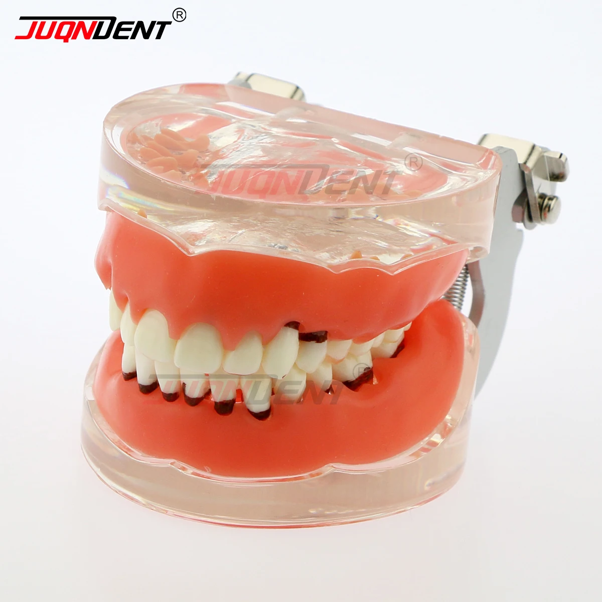 JUQNDENT Dental Teaching Models Dental Adult Periodontal Disease Pathological Teeth Typodont M4017 Model Removable