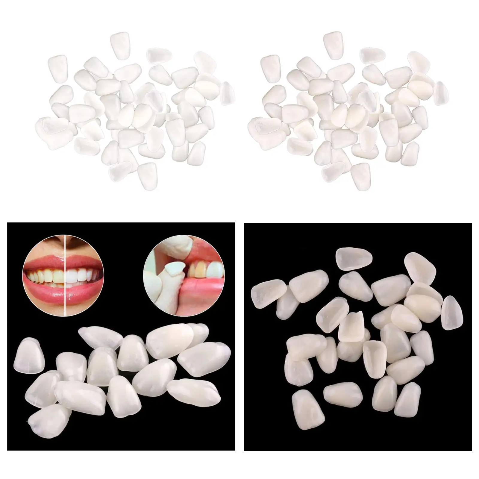 -Thin Dental Tooth Temporary Veneers Upper Anterior Front Resin.