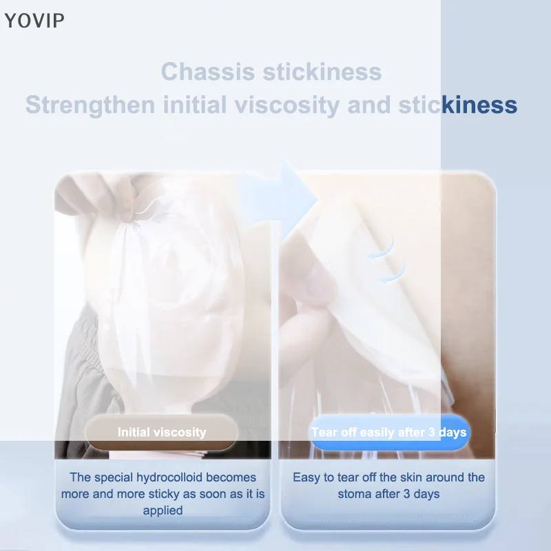 /YOV/One-piece Colostomy Bags Disposable Ostomy Drainable Single Tie Pouch For Stoma Care Bags 1Pcs