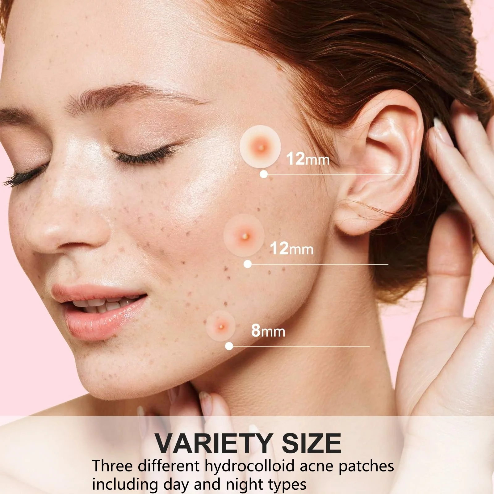 Hydrocolloid Acne Patches: Essential Acne Patches for Every Occasion | Invisible, Breathable, and Traceless, Gentle on Skin, Wat