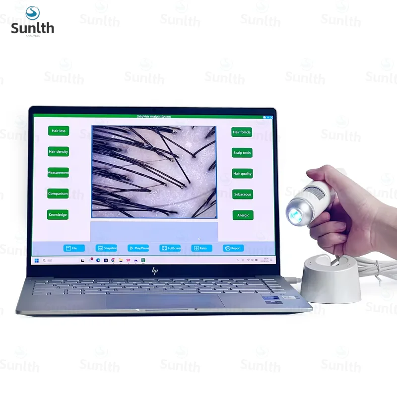 レポート付き Windows システム USB 接続毛包スキャン ハンドヘルド皮膚および毛髪分析装置 OTG 付き顕微鏡拡大鏡