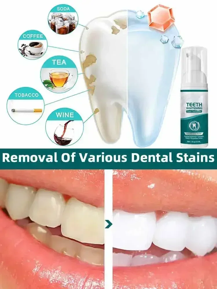 Teeth Whitening Essence Remove Plaque Stains Oral Hygiene Bleaching Products Cleansing Fresh Breath Dentistry Care