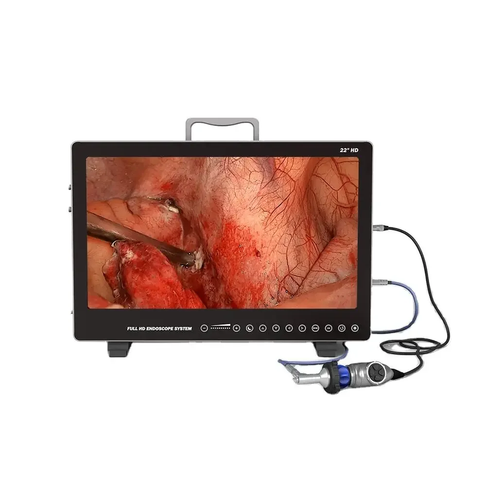 Cheapest integrated medical ent endoscope camera Endoscopic wifi 360 degree camera-endoscope Laparoscope imaging system