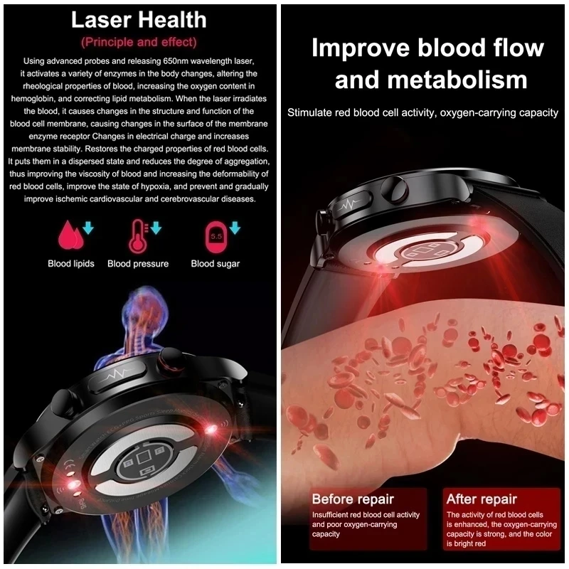 2025 New Laser Therapy Blood Glucose ECG+PPG Smart Watch Men Heart Rate Uric Acid Healthy Heart pulse IP68 Waterproof Smartwatch