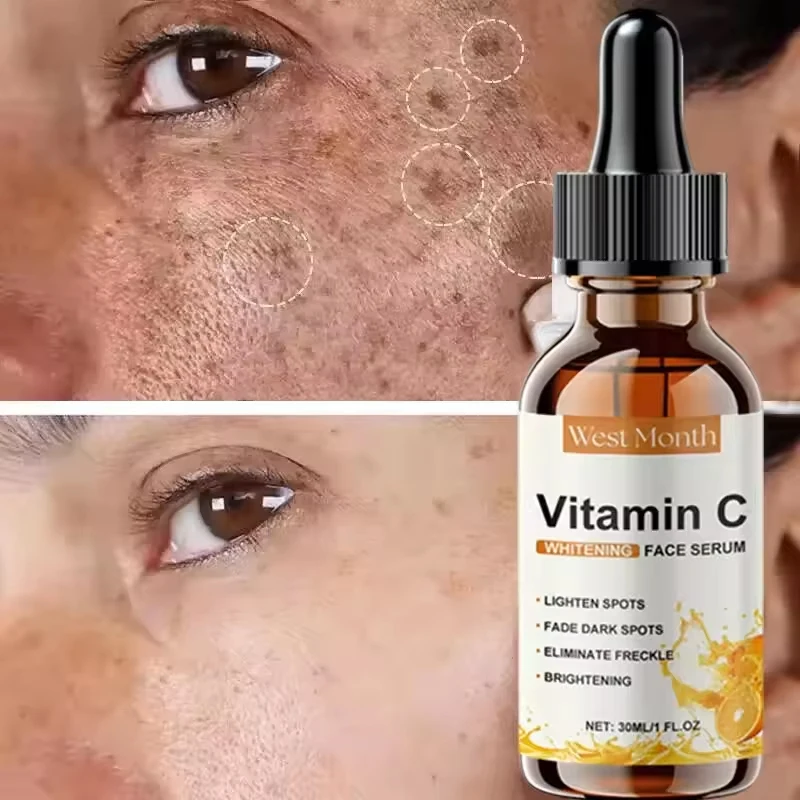 Vitamin C Whitening Essence Dark Spot Correcting Glow Face Serum Fade Melasma Melanin Brightening Repair Dull Skin Care Cosmetic