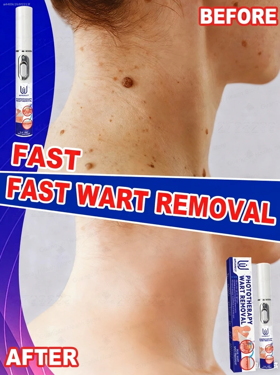 

7 Days Wart-Free Challenge – Guaranteed Effective Wart Elimination