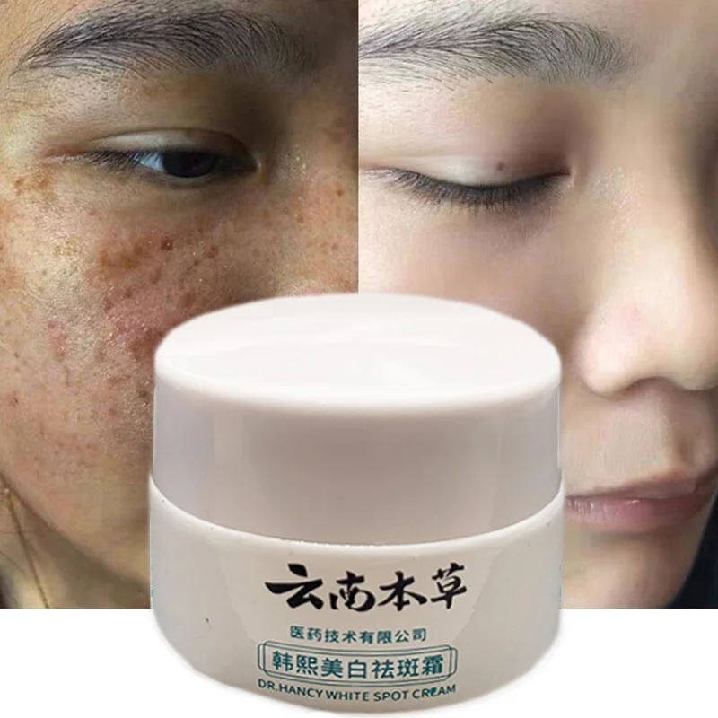 

20G ZB Yunnan Herb Powerful Whitening Freckle Cream Remove Acne Spots Melanin Dark Spots Face Moisturizing Face Skin Care Beauty