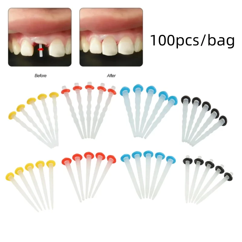 

100 шт./упак. Стоматологические кварцевые фибровые штифты с прямым винтовым креплением, стоматологические фибровые штифты из смолы для восстановления корневых каналов, эндодонтический инструмент