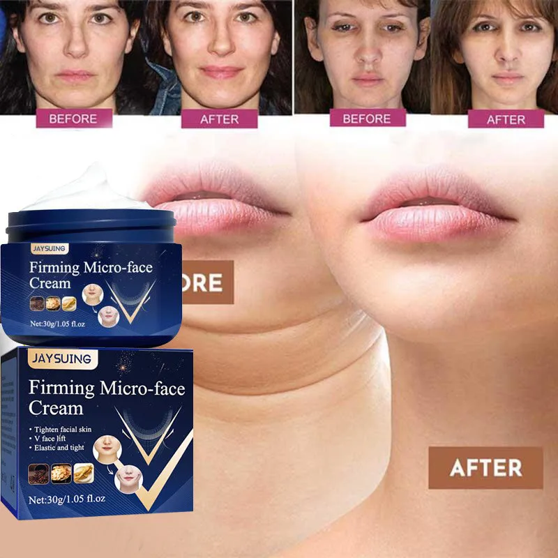 

Face-lift Slimming Cream Thin V Face Lift Firming Removal Masseter Muscle Double Chin Anti-aging Moisturizing Beauty Skin Care