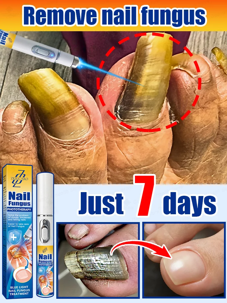 

2025 Hot sale Say goodbye to nail troubles Simple and convenient