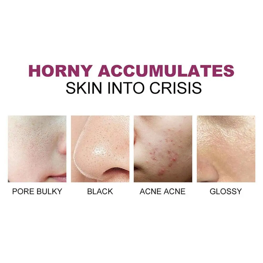 Gel creme esfoliante para mulheres, amaciar cutícula, clarear esfoliante, reparar a pele facial, cuidados de clareamento, limpeza profunda, hidratante, O1A9, 40g