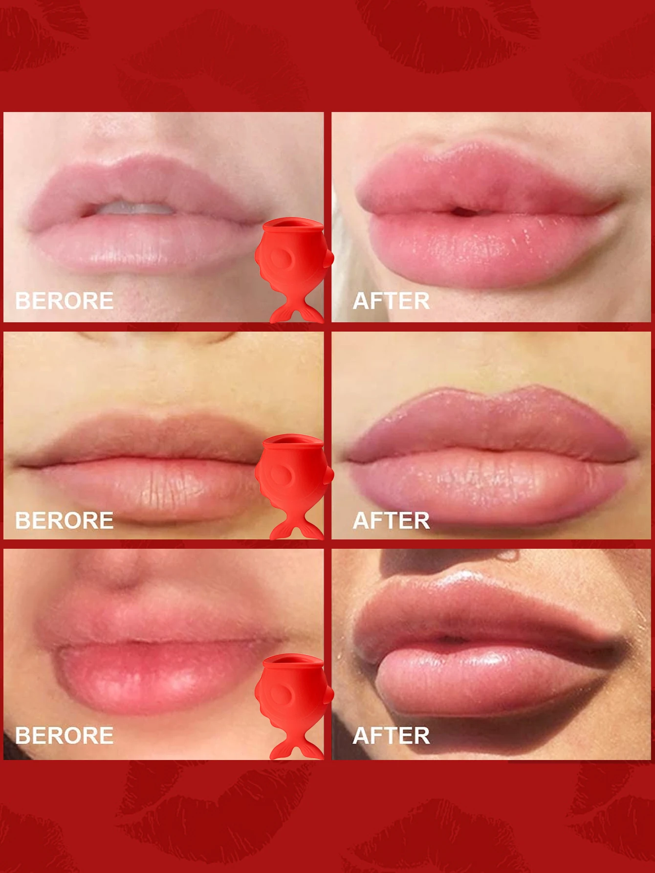 جهاز سمنة الشفاه للشفاه الكاملة - قطعة واحدة من أداة نفخ الشفاه المصنوعة من السيليكون على شكل فم السمكة اللطيفة