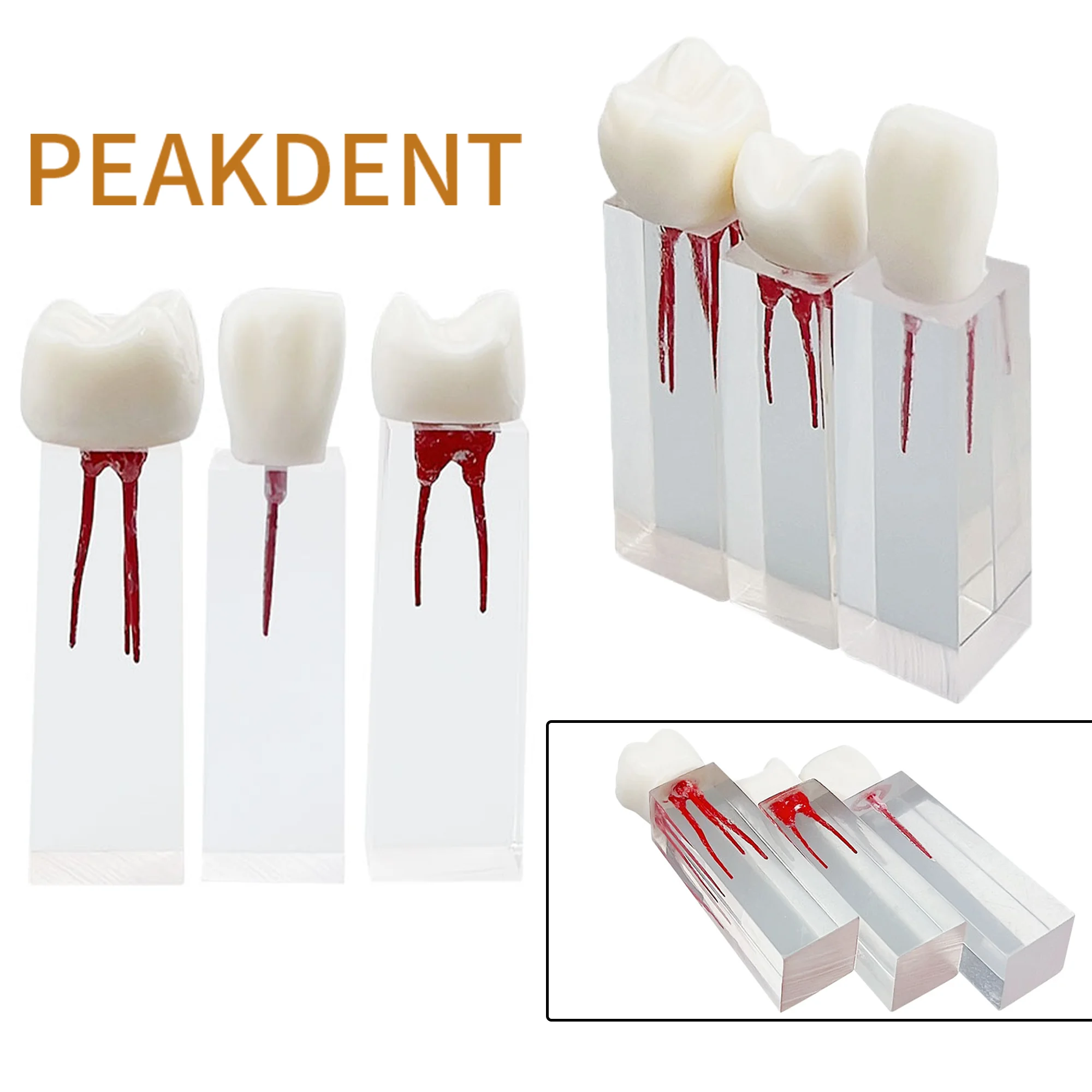 Dental Teeth Endodontic Teaching Study Model Dentistry Endo Root Canal Model Dentist Student Study Practice Dentistry Tools