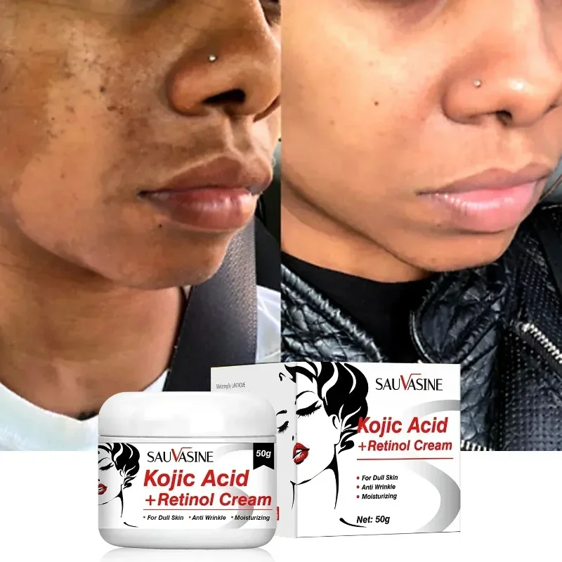 Retinol Cream Skin Whitening Cream Anti Aging Brighten Fade Stubborn Remove Dark Spots Moisturiz Nourish Facial Skin Care New