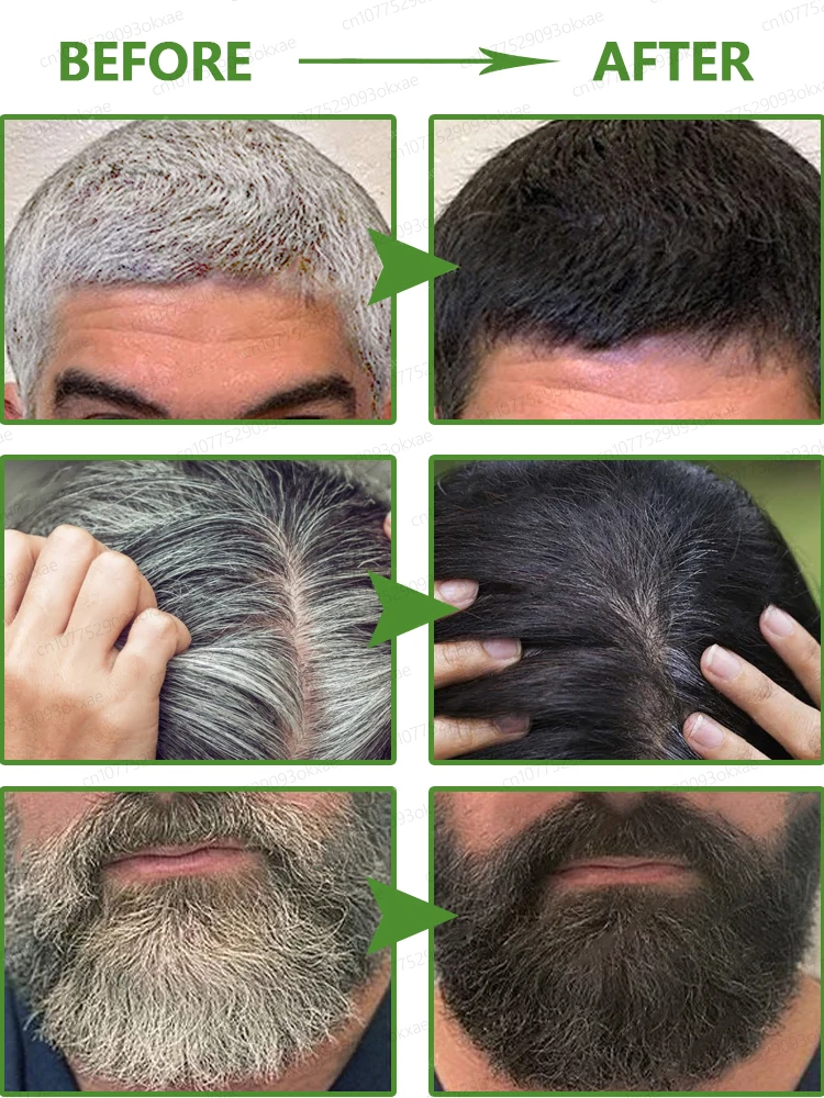 Anti-grey hair serum to restore gray beard and hair to their natural color