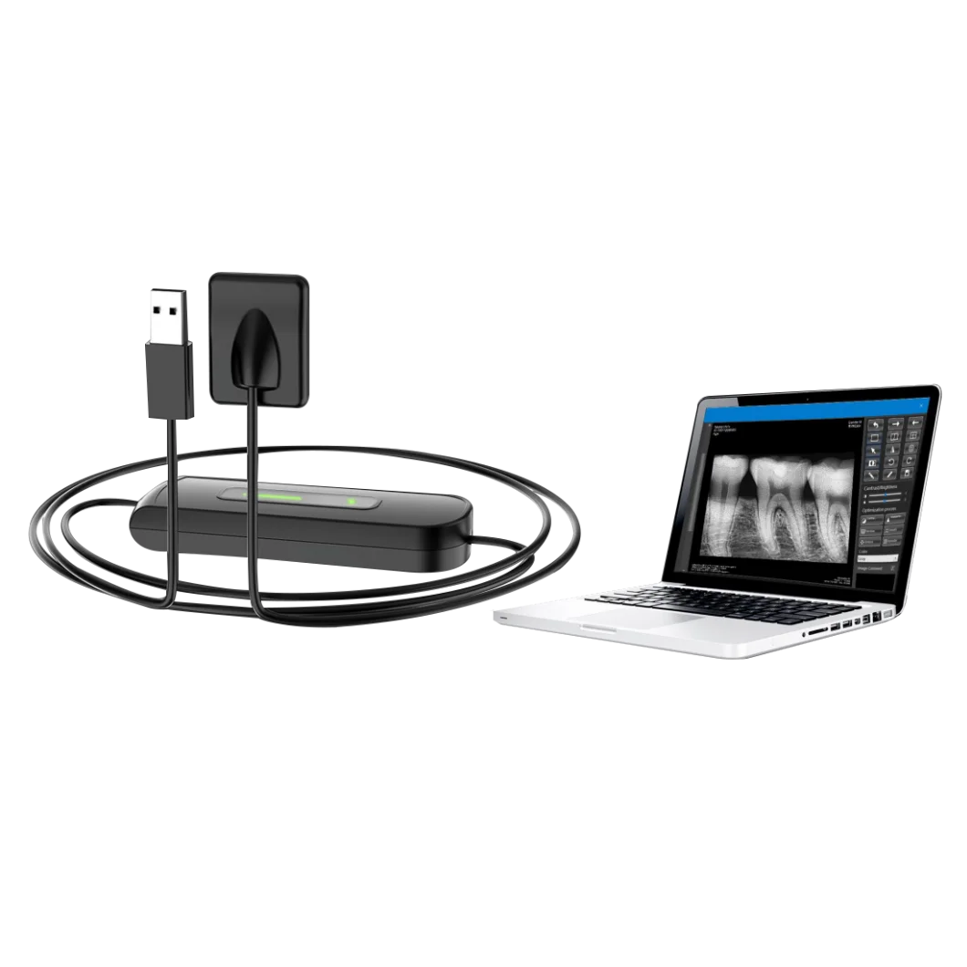 Cost-effective High Definition Digital RVG Den-tal Intraoral X-Ray Sensor