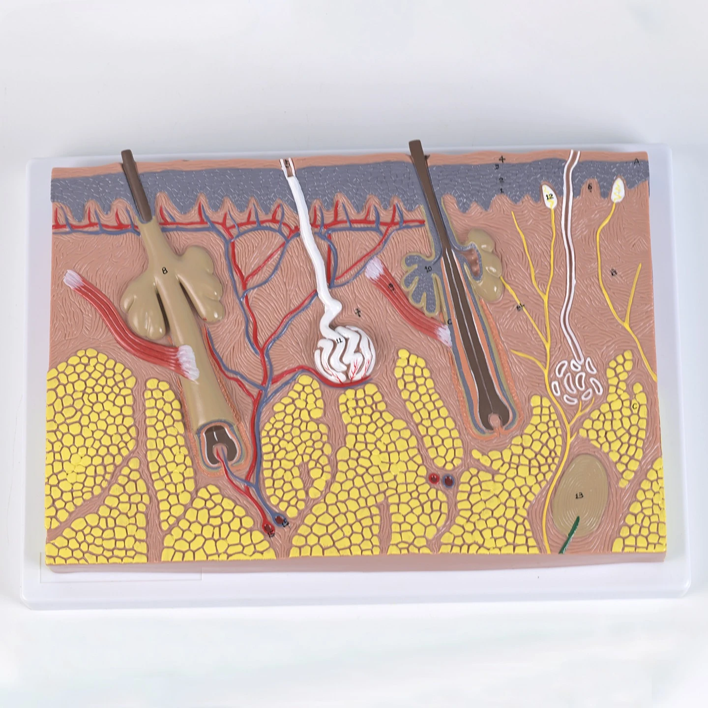 

Plane Skin Anatomy Model Skin Hierarchy Epidermis Subcutaneous Tissue Teaching Model