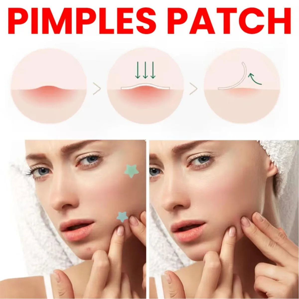 Patches para acne, 200/1000 peças, patch coloidal à base de água, patch para acne, cobrindo imperfeições faciais, ultrafino, invisível, adequado para 
