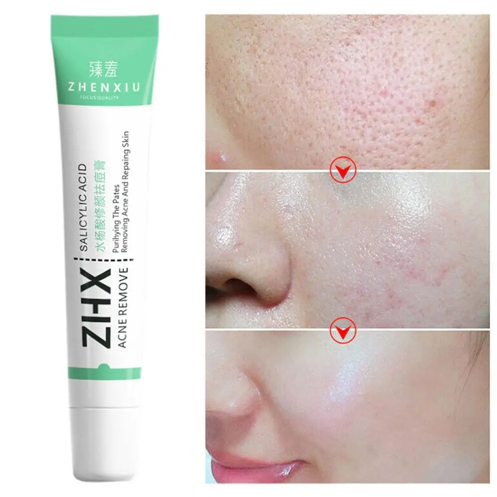 Salicylic Acid Shrink Pore Cream Elimination Large Pores Remove Blackehead Face Smooth Repairing Skin Care Product