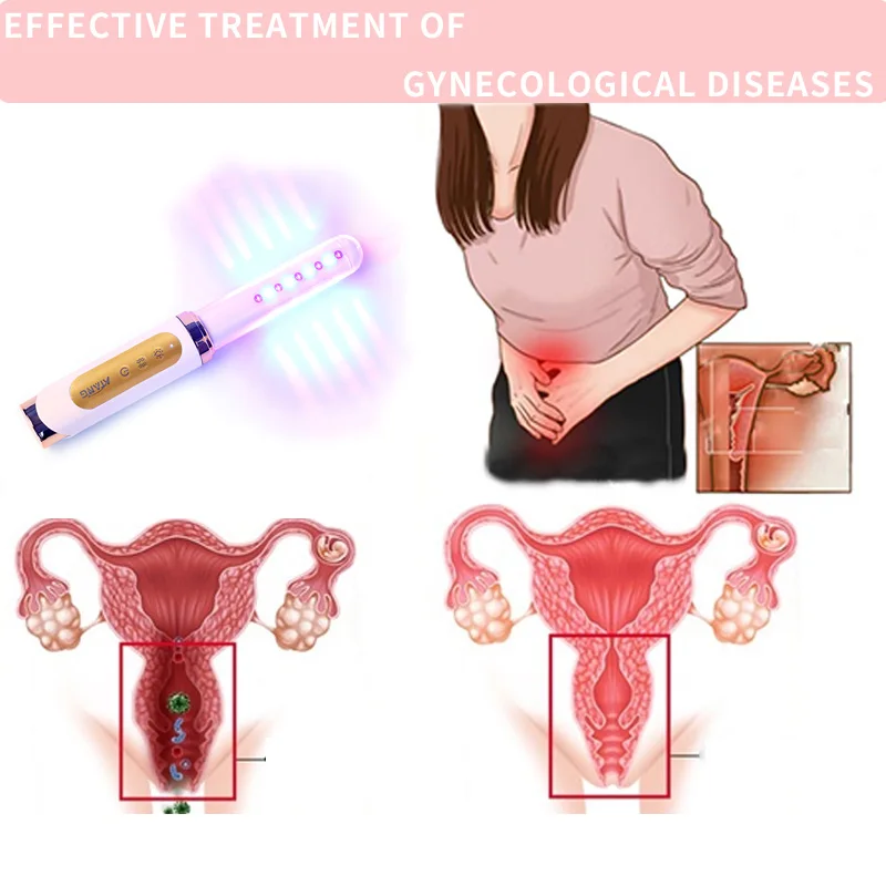 Virgin Infection Rehabilitation Equipment Cold Laser Vaginal Tighten Wand Women Health Care Erosion Treatment Home Use